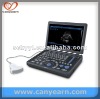 CE U612/A12 Laptop Ultrasound Machine