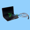 Portable medical ultrasound scanner YSB0122