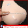 Spiral shaped lightweight silicone breast forms for mastectomy