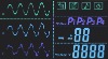 lcd display for Medical equipment